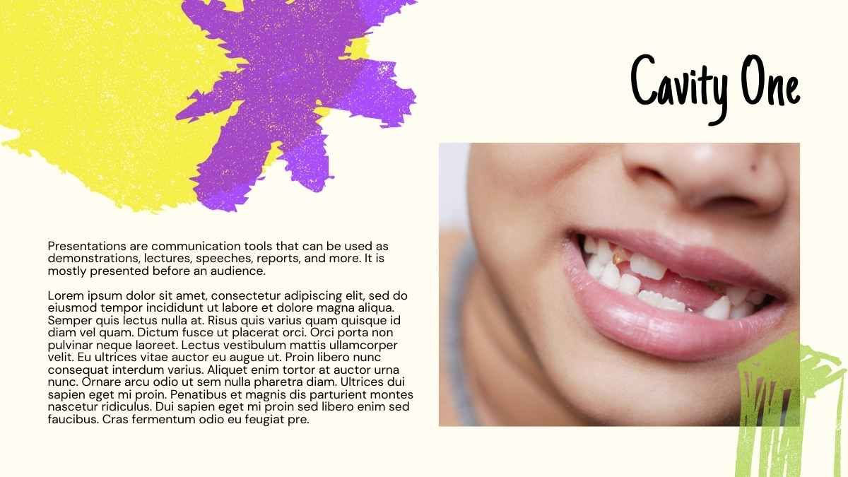 Cute Cavity Preparation In Primary Teeth Slides - diapositiva 13