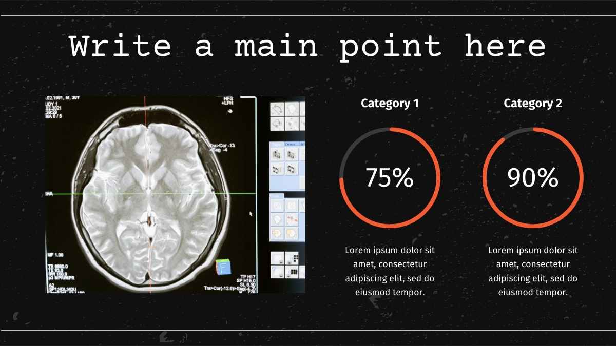 Dark Simple Traumatic Brain Injury Slides - slide 11