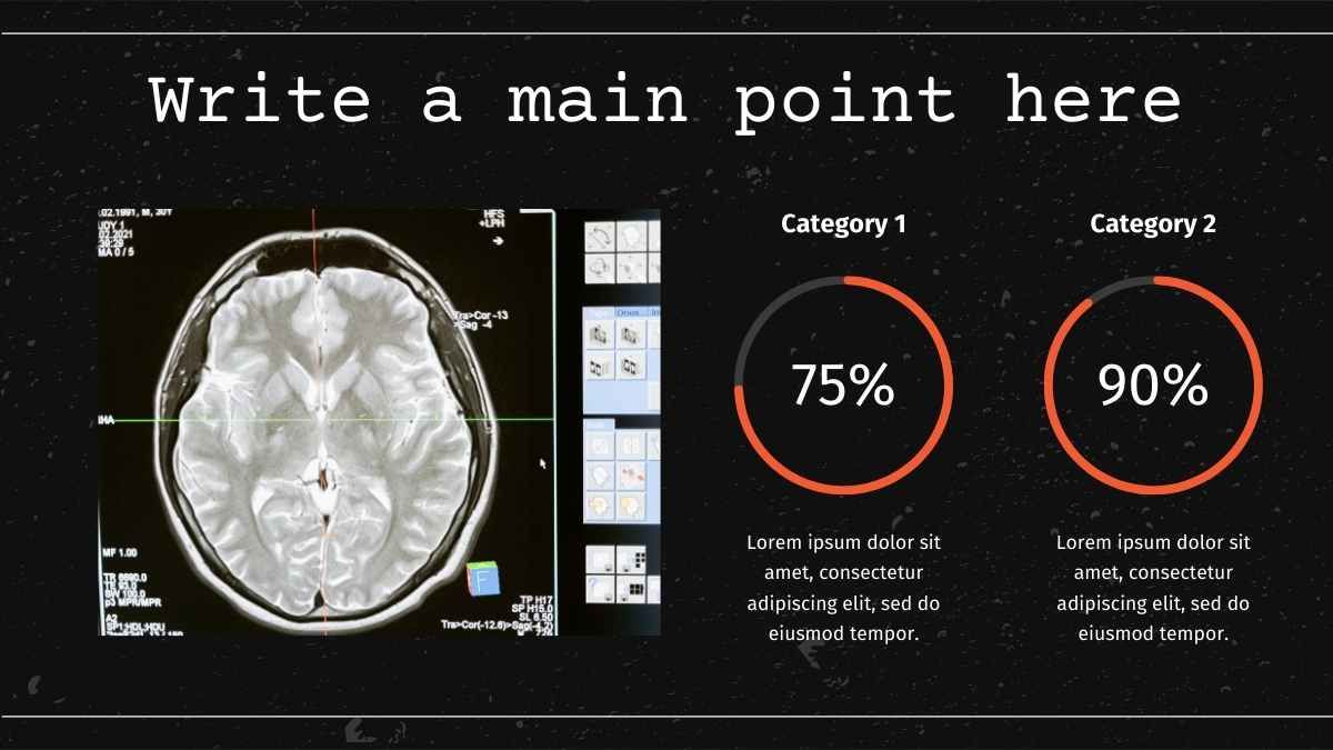 Dark Simple Traumatic Brain Injury Slides - diapositiva 11