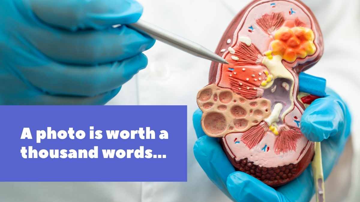 Illustrated World Kidney Day Slides - slide 12