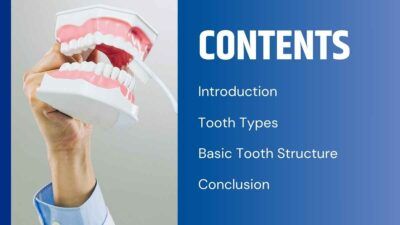 Minimal Structure Of Tooth Slides