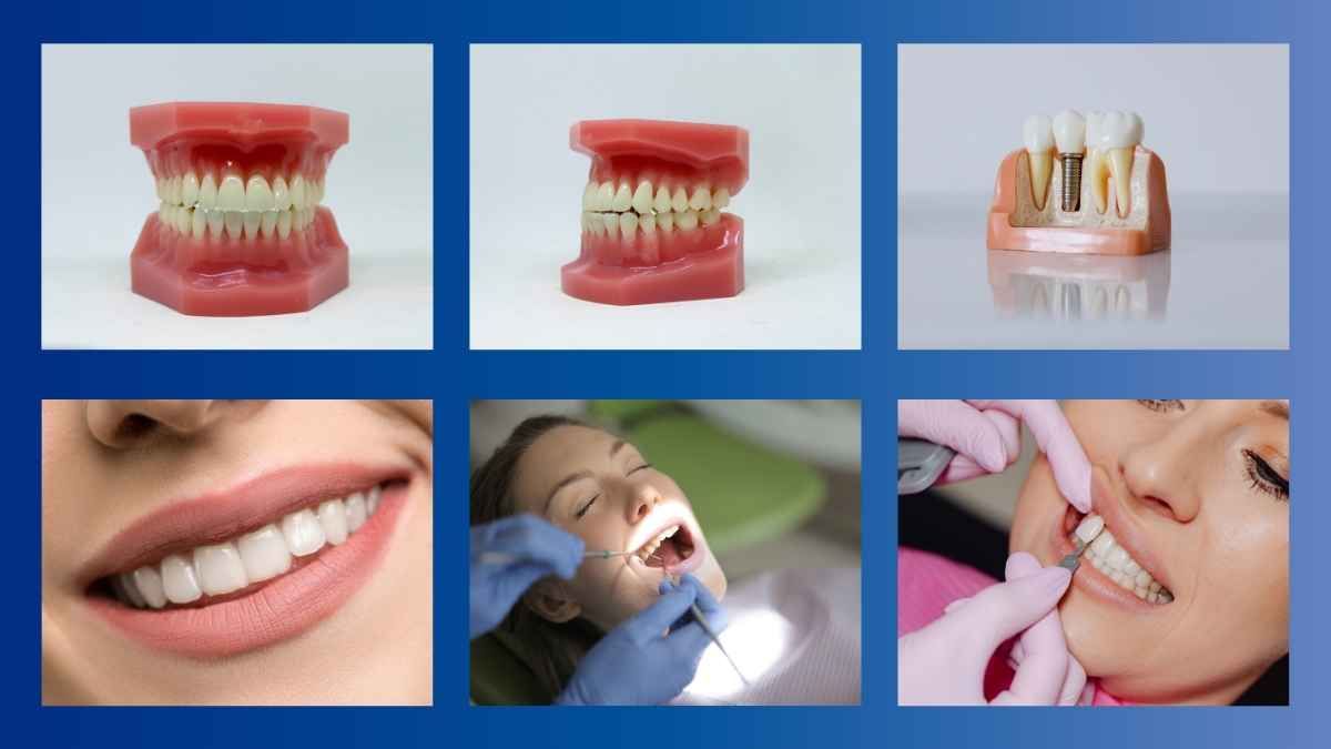 Minimal Structure Of Tooth Slides - diapositiva 11