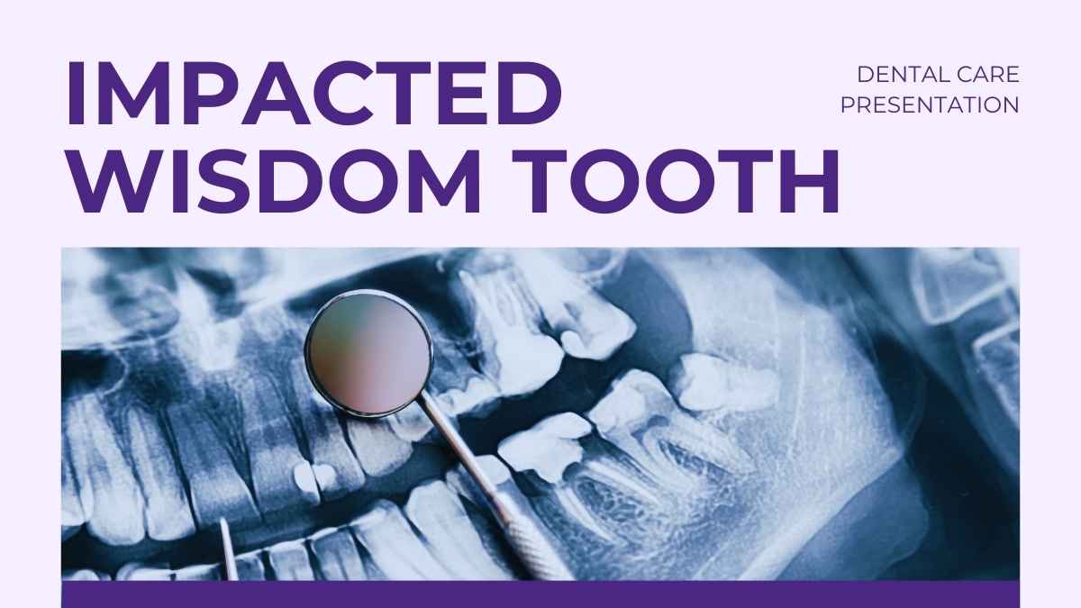 Simple Impacted Wisdom Teeth Slides - slide 1