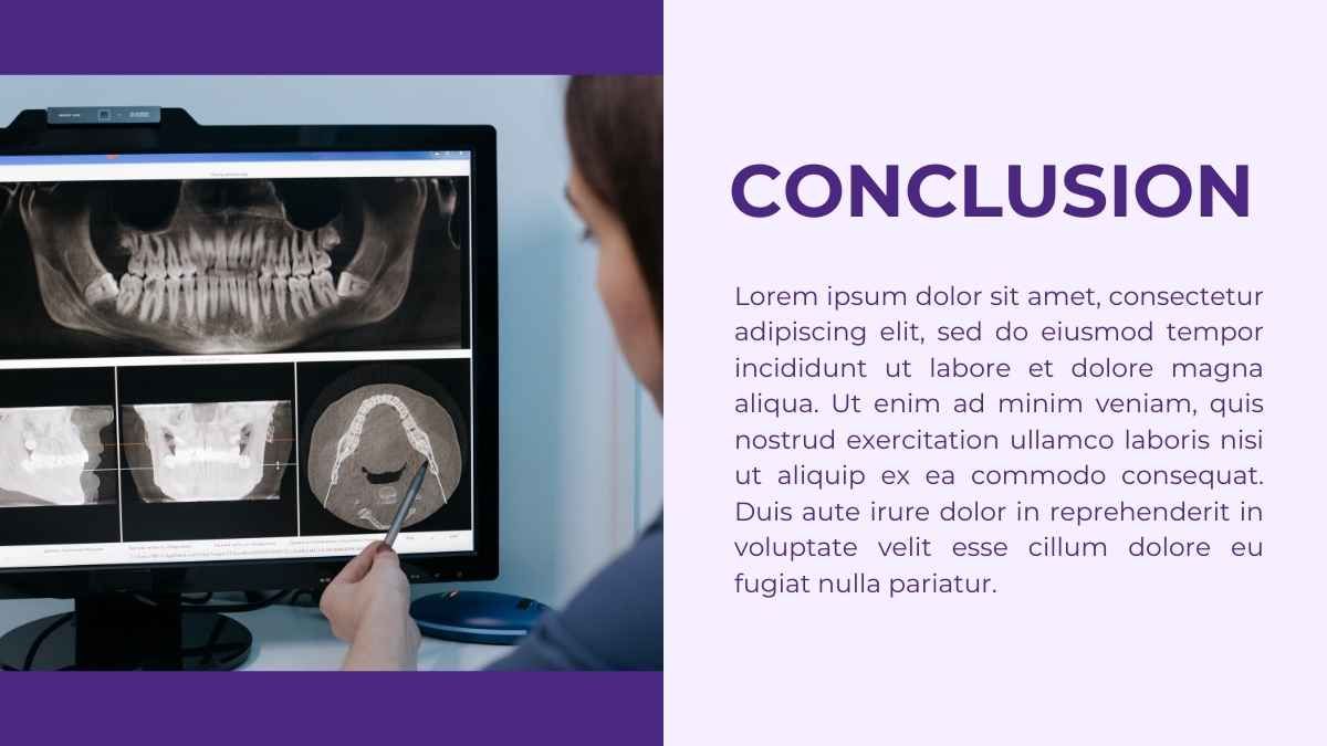 Simple Impacted Wisdom Teeth Slides - diapositiva 11